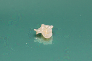 自身の歯の治療は院内にて完結