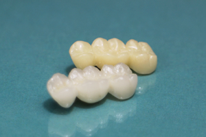 みんな白い歯をセットしています。